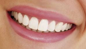Newton Dental Associates Perfect Smile