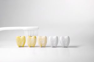 tips for preventing tooth stains